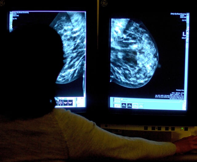 More than 1,500 'missing' cancer diagnoses in Devon in 2020 – as fewer found at early stage